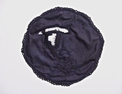 Nasty Magpie: "Being chased by irate magpie while horseriding. Fell; landed on ground- Fracture"